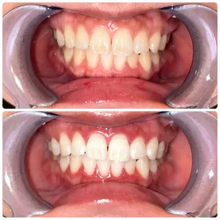 cona whitening神保町所属・ホワイトニング 神保町店/杉浦のエステ・リラクイメージ