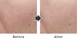 NARIS BEAUTY STATION　デ・アイム 長崎所属・立石 文香のエステ・リラクイメージ