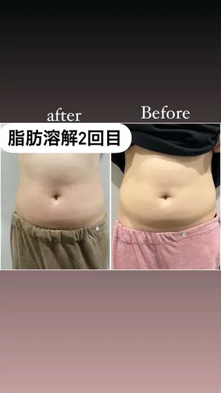 毛穴洗浄・痩身・脱毛 /アルカンジュのエステ・リラクイメージ