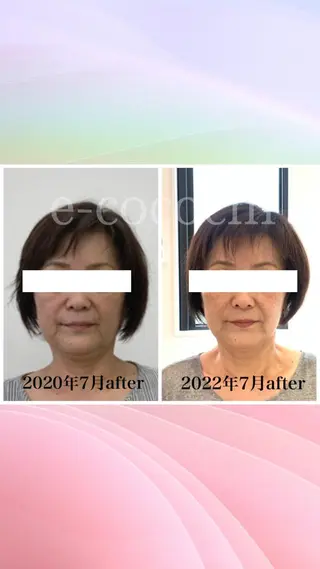 小顔と ヘッドスパのお店のエステ・リラクイメージ