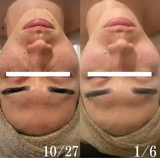 中目黒ハーブピーリン グ🌿ララピールのエステ・リラクイメージ