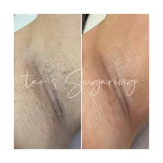 Sugaring / HILOT TAOのエステ・リラクイメージ