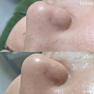 emirai 🌙AYANOのエステ・リラクイメージ