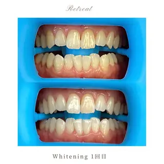 Retreatリトリート所属・歯科医院提携 Retreatのその他イメージ