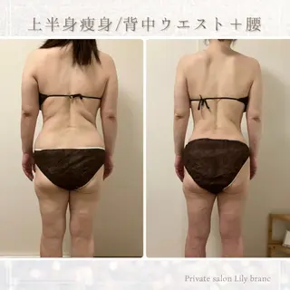 Lily branc 痩身/小顔/肌質改善のエステ・リラクイメージ