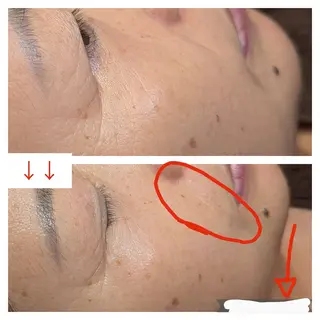 肌質改善プライベートサロンwith U所属・肌質改善サロン with Uのエステ・リラクイメージ