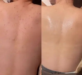 for woman所属・森 美優のエステ・リラクイメージ