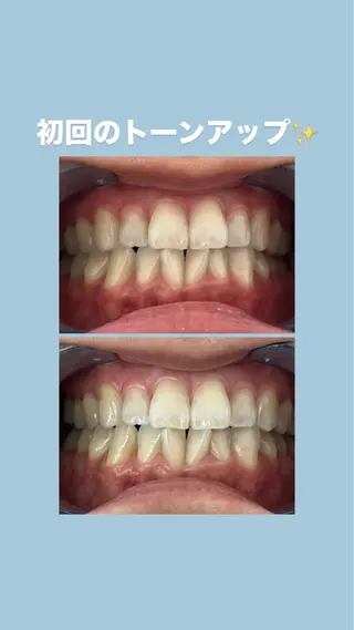 セルフホワイトニングサロンエクシアホワイト倉敷店所属・ecxiawhite 倉敷店のエステ・リラクイメージ