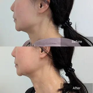 nail RiRi アトレナチュラのエステ・リラクイメージ