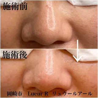 大久保 里奈のエステ・リラクイメージ