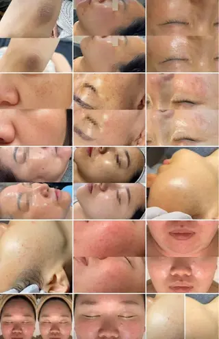 マツエク・マツパ aliaハイフ&水光ジェットサロン所属・aliaハーブ水光店 エステティシャン募集のエステ・リラクイメージ