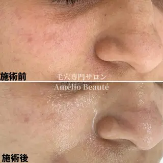 毛穴ケア専門サロン Amélio Beauté所属・毛穴ケア専門サロン アメリオボーテのその他イメージ