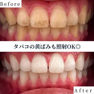 ホワイトニング ショップ茨木店/増田のその他イメージ