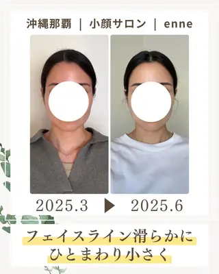 小顔サロンenne所属・小顔サロンenne 【エンネ】のその他イメージ