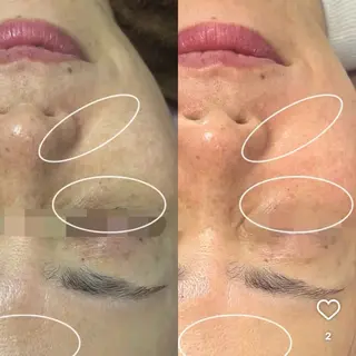 美肌・小顔専門🪄 看護師施術/松﨑のエステ・リラクイメージ