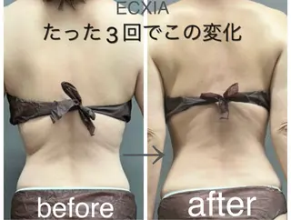 ECXIA 【エクシア】のエステ・リラクイメージ