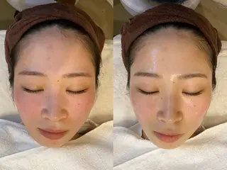 ハーブピーリング🌿 脱毛🧡ヘッドスパのエステ・リラクイメージ