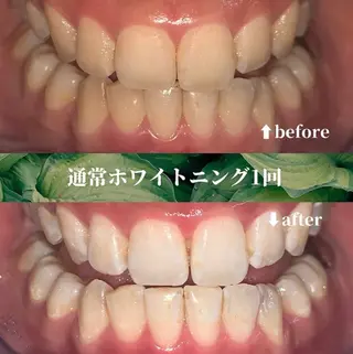 futaba ホワイトニング/天神のエステ・リラクイメージ