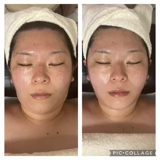 メディカルエステ 痩身·小顔専門サロンBBC 田園調布所属・KEI KOのエステ・リラクイメージ