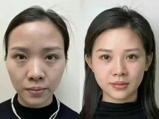 マツエク・マツパ aliaハイフ&水光ジェットサロン所属・aliaハーブ水光店 エステティシャン募集のエステ・リラクイメージ