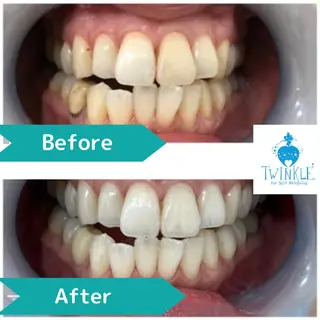 Twinkle White上尾店のエステ・リラクイメージ