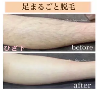 キッズ miilove 鹿児島店のエステ・リラクイメージ