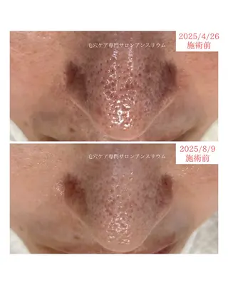 毛穴ケア専門サロンアンスリウム所属・茨城土浦 つくば毛穴 ケア専門サロンのエステ・リラクイメージ