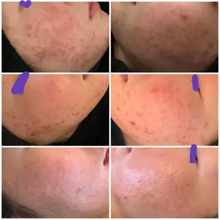 星 亜也加のネイルデザイン