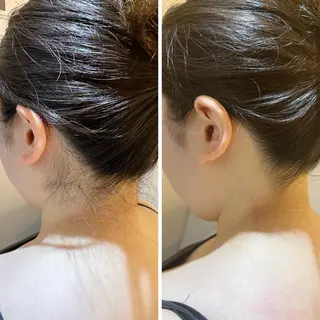 うなじ脱毛/美肌脱毛 LABELのエステ・リラクイメージ