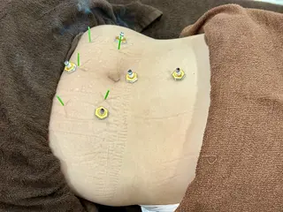 鍼灸HARIKARA所属・辛島 昴のエステ・リラクイメージ