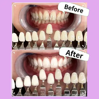 whitebase所属・蘇我ホワイトニング White baseのその他イメージ