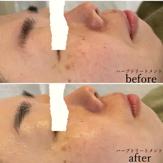 ulu 眉毛ハーブ毛穴肌改善の眉毛・アイブロウイメージ