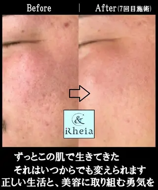 メンズ ＆Rheia（アンドレイア）所属・kawashima mariの眉毛・アイブロウイメージ