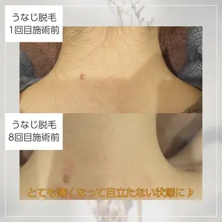 vary  clue MISAのエステ・リラクイメージ