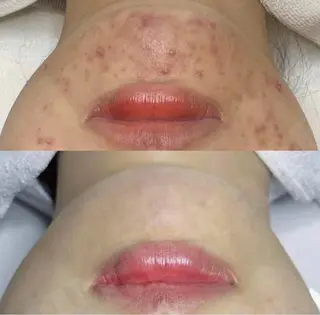 【新宿】 PulBeauteのエステ・リラクイメージ