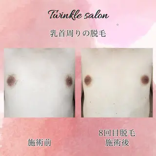 メンズ 中井 光明の眉毛・アイブロウイメージ