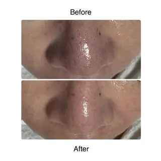 ROR所属・ROR nailのエステ・リラクイメージ