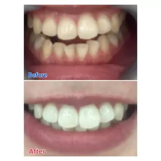 MBEAUTYSALON 千葉店・京成大久保所属・Melty 輝のその他イメージ