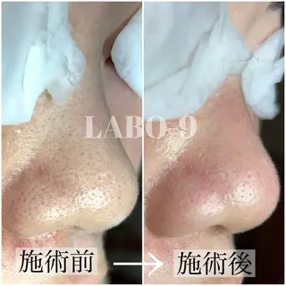 LABO-9所属・田中 捺未のエステ・リラクイメージ