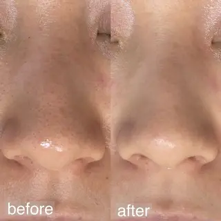 アイブロウ&フェイシャルサロンa‘lm所属・WAX脱毛/肌質改善 眉毛とお肌のサロンのエステ・リラクイメージ