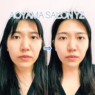 小顔美容鍼専門サロン 渋谷YZのエステ・リラクイメージ