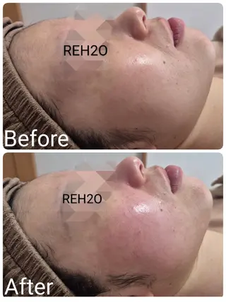 REH2O所属・REH2O Rihoのエステ・リラクイメージ