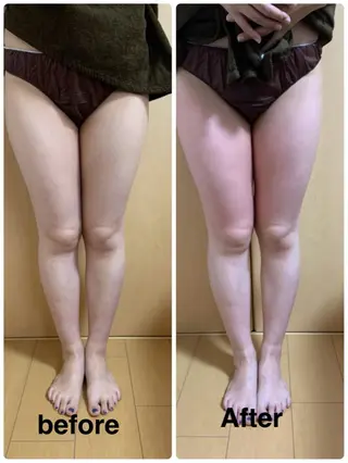 痩身/脱毛/ネイル HARUKAのエステ・リラクイメージ