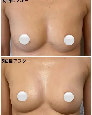 バストアップ専門店HAKU所属・茨田 恵のエステ・リラクイメージ