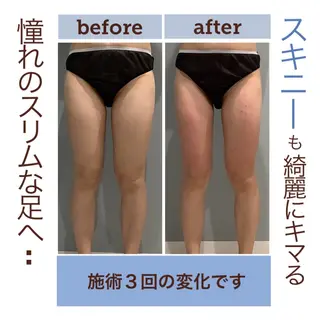 エステサロン JURISのエステ・リラクイメージ