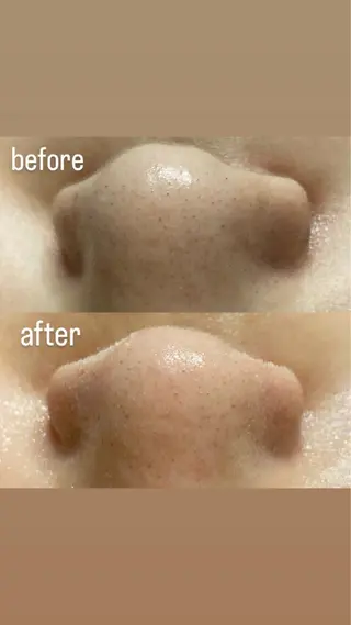 磐田｜LAYLA 一番丁寧な脱毛店のエステ・リラクイメージ