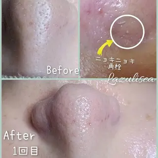 エステサロン　Lazulisea所属・川口 春奈のエステ・リラクイメージ