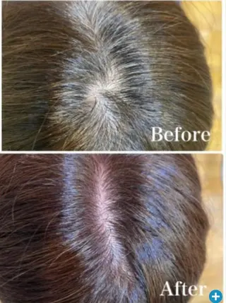 カラー BEAUTRIUM 福岡所属・ショートカット／ 明千のヘアスタイル