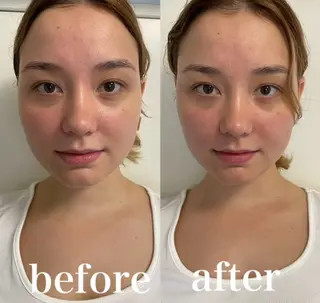 美容鍼灸サロン mahoroba院長のエステ・リラクイメージ