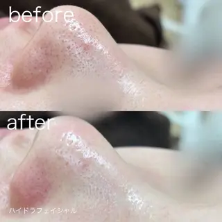 lulula ricoのエステ・リラクイメージ